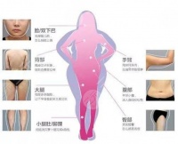 吸脂瘦腿果怎么样?吸脂瘦腿案例