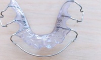 儿童乳牙掉了需要做牙齿间隙保持器吗？家长经验谈，利弊及实例都在这