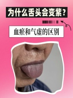 为什么舌头会变紫？血瘀和气虚的区别