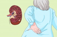 尿毒症会不会死