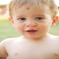 猕猴桃小孩可以吃吗