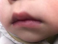 猕猴桃吃多了不止反酸烧心，这些隐藏的健康风险你真的清楚吗？