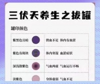 三伏天的健康守護(hù)：拔罐與夏季養(yǎng)生