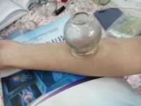 拔罐頻率別亂選，搞懂體質(zhì)部位時(shí)長(zhǎng)標(biāo)準(zhǔn)才是真養(yǎng)生？