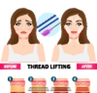 怎么大量抽脂瘦臉減肥