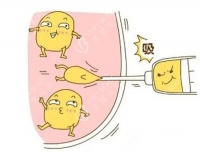 腰腹吸脂20天感覺就和沒抽一樣：一文解答其中原因及術(shù)后改善過程解析