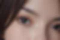 微創(chuàng)吸脂 醫(yī)生詳解手術(shù)全過(guò)程