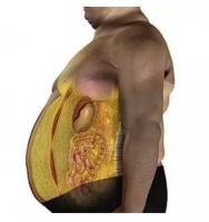 想減肥，能不能來(lái)兩片瘦素？