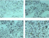 刘仲华院士团队说安化黑茶降脂减肥功效