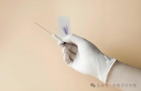 穴位埋线减肥安全吗？