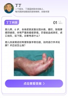 手指粘成球，皮肤一碰就破，多家三甲不敢收，华西凭什么敢开刀？