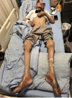 应对2.5亿高尿酸人群健康挑战 杭州家门口新增浙江康静医院痛风医学中心