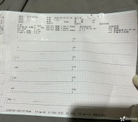 女子「自缢身亡」，尸斑遍布！120 到场后，被问打没打殡仪馆电话，我反问一句……