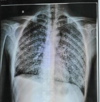 28 岁小伙突然发疯，看完片子主任直呼这么经典很少见