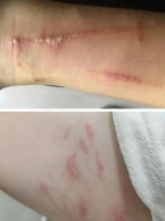 河南近期高发，警惕“飞行的硫酸”！