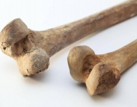 年龄大了骨量流失加快？提醒父母：这3种“偷钙”大菜，尽量少吃