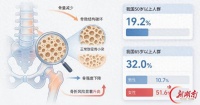 这些被忽略的“小毛病”，其实是骨骼在“报警”