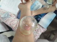 拔罐的十大功效全解析，居家高效养生选对工具很关键！